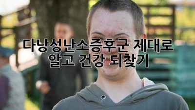 다낭성난소증후군, 제대로 알고 건강 되찾기